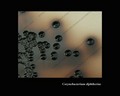 corynebacterium diphtheriae